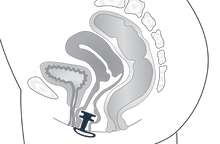 Afbeelding in Gallery-weergave laden, EFEMIA Blaassteun